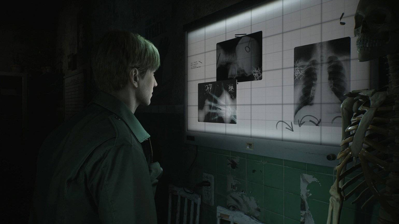 Начмед в деле Silent Hill 2 Remake смотреть онлайн