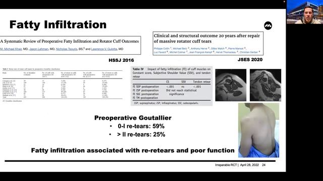 Predicting the Repairability of Massive Irreparable Rotator Cuff Tears смотреть онлайн