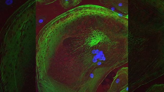 TNF-alpha Activated Macrophages смотреть онлайн