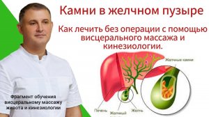 Камни в желчном пузыре