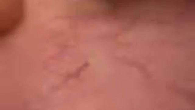 940 nm red blood removal machine смотреть онлайн