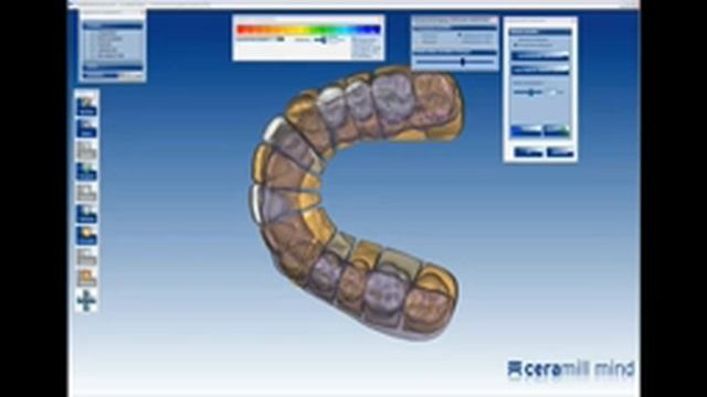 Виртуальный артикулятор ARTEX от Amann Girrbach