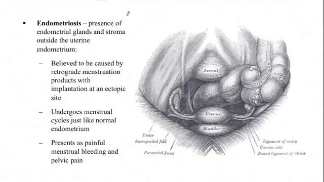 Uterus Anatomy [Pelvis Anatomy 7 of 11] смотреть онлайн