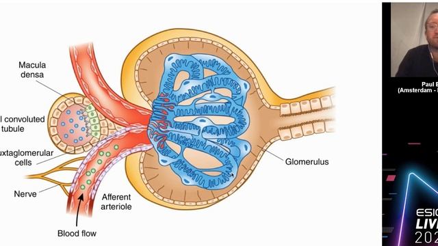 Intravenous fluids and acid base derangements Paul Elbers 2020
