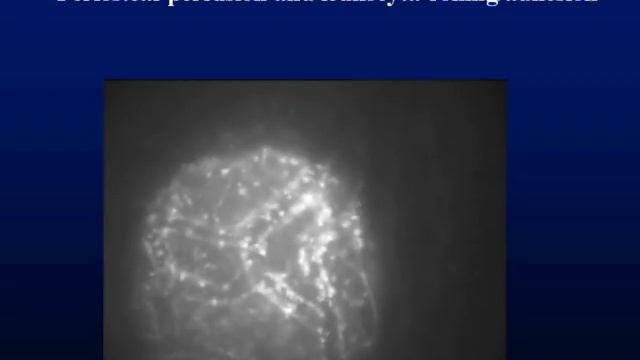 Resuscitation and the microcirculation József KASZAKI summerBuda2011