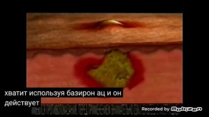 базирон ас 2010 реклама