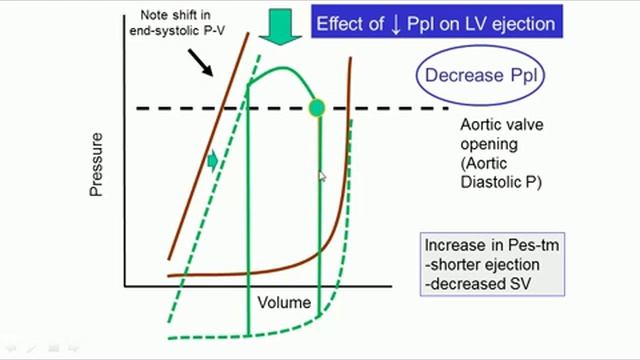 PULSUS PARADOXUS MECHANISMS AND CLINICAL USE Seldon Magder 2015