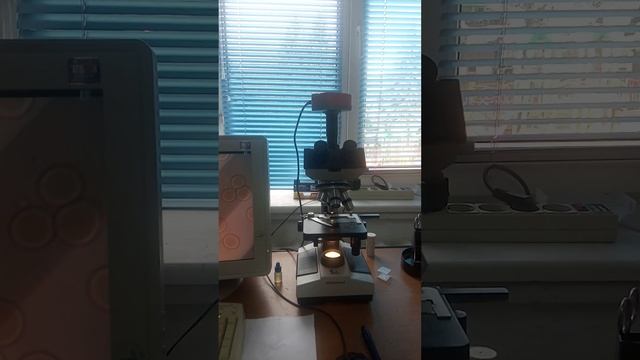Исследование крови смотреть онлайн