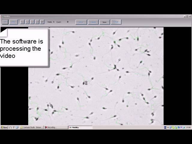 MMC Sperm: Sperm Motility Analysis In Bright Field