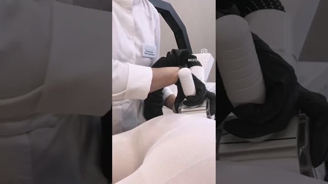 LPG массаж смотреть онлайн