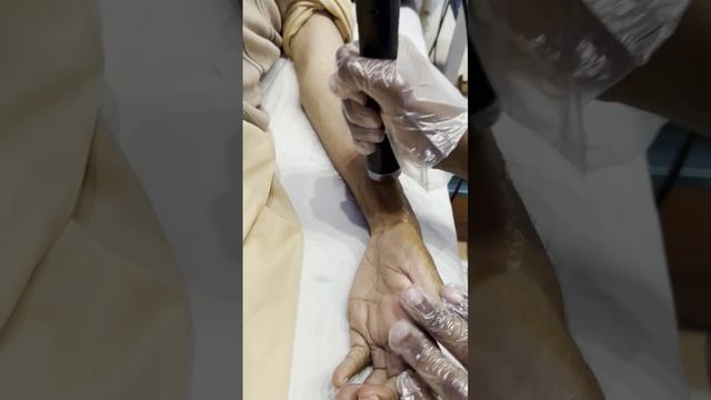 ultrasound therapy for wrist contracture #shorts #physiotherapy #drhafizhassan смотреть онлайн