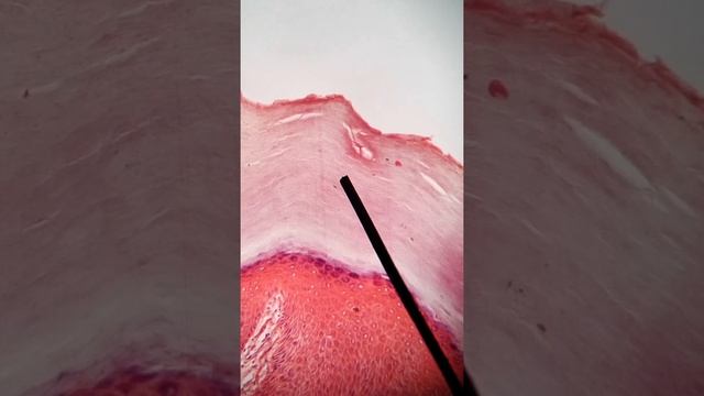 ALERTA: LA PIEL TIENE UNA CAPA DE CÉLULAS MUERTAS -capa córnea de la epidermis- #piel #histología смотреть онлайн