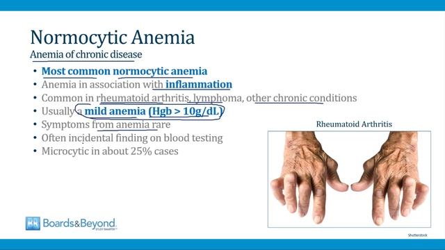 1.Normocytic Anemias смотреть онлайн