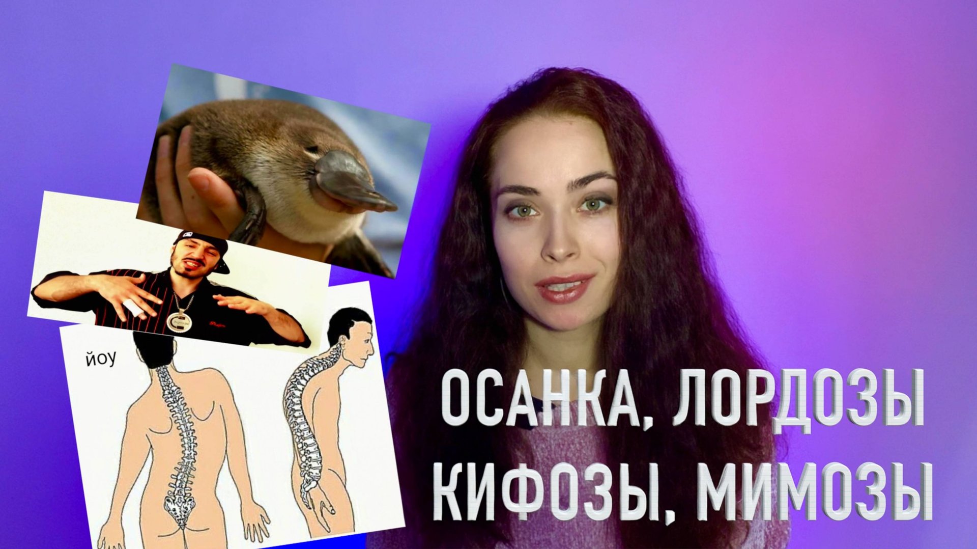 Все, что вы стеснялись спросить про осанку. Гиперлордоз, кифоз, сколиоз..