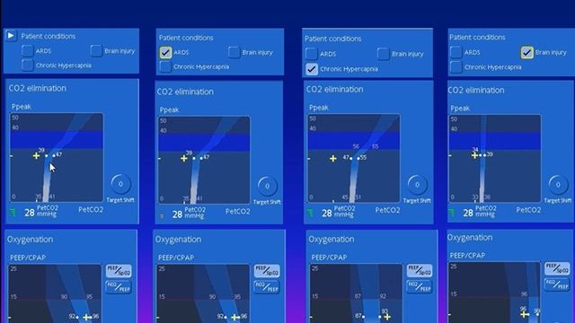 INTELLiVENT-ASV - The concept Jean-Michel Arnal 2014