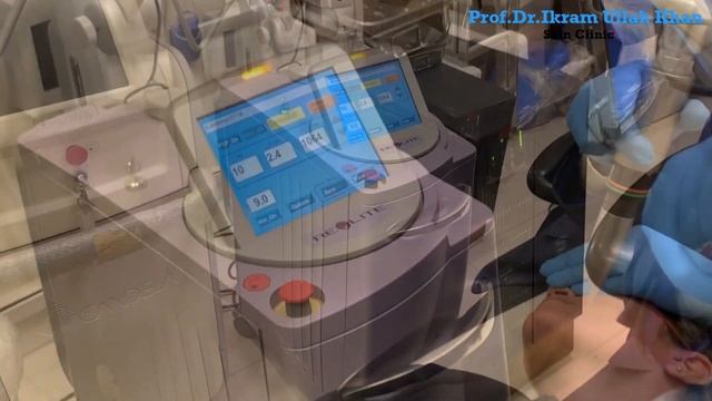 Melasma Makeover: Prof Dr Ikram Ullah Khan's Revlite SI Laser Solution! #melasma #lasertreatment смотреть онлайн