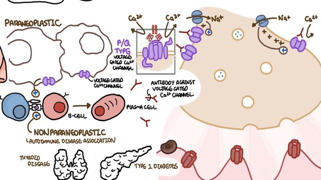 Lambert-Eaton Myasthenic Syndrome - pathophysiology, signs and symptoms and treatment смотреть онлайн