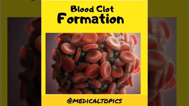 Blood Clot Formation смотреть онлайн