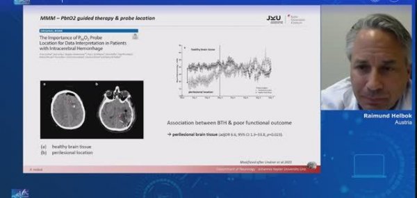 CEREBRAL OXYGENATION IN CRITICAL CARE webinars ESICM 22