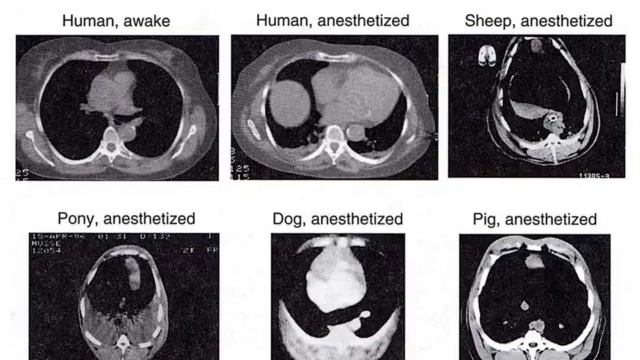 1 What do we breath for Goran HEDENSTIERNA summerTurin2011