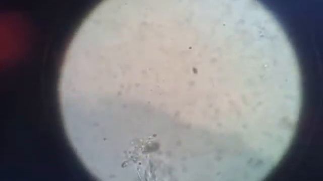 Phytoplankton Phytoplex de Kent Marine 1000X смотреть онлайн