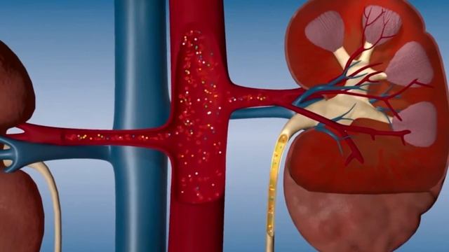 Medicina para todos: Cuidados para el riñón смотреть онлайн