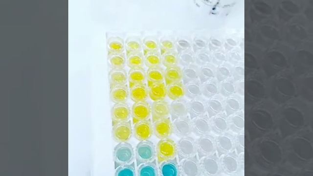 Como se hace? Hepatitis b Hbsag Elisa смотреть онлайн