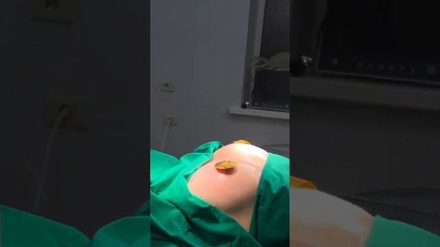 Результат после аугментационной маммопластики смотреть онлайн