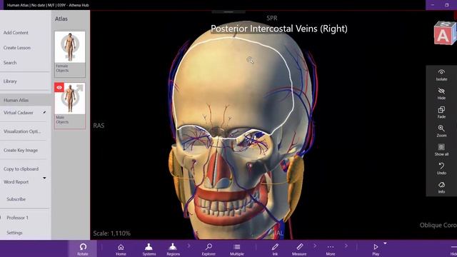Human Anatomy Atlas with organs transparency - Athena Hub смотреть онлайн