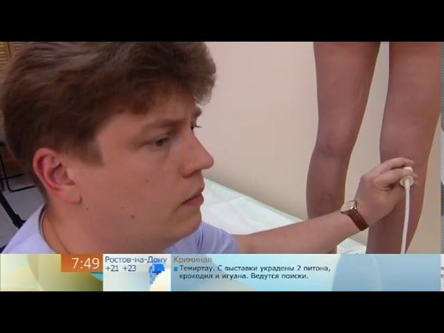 Чем неприятен варикоз? смотреть онлайн