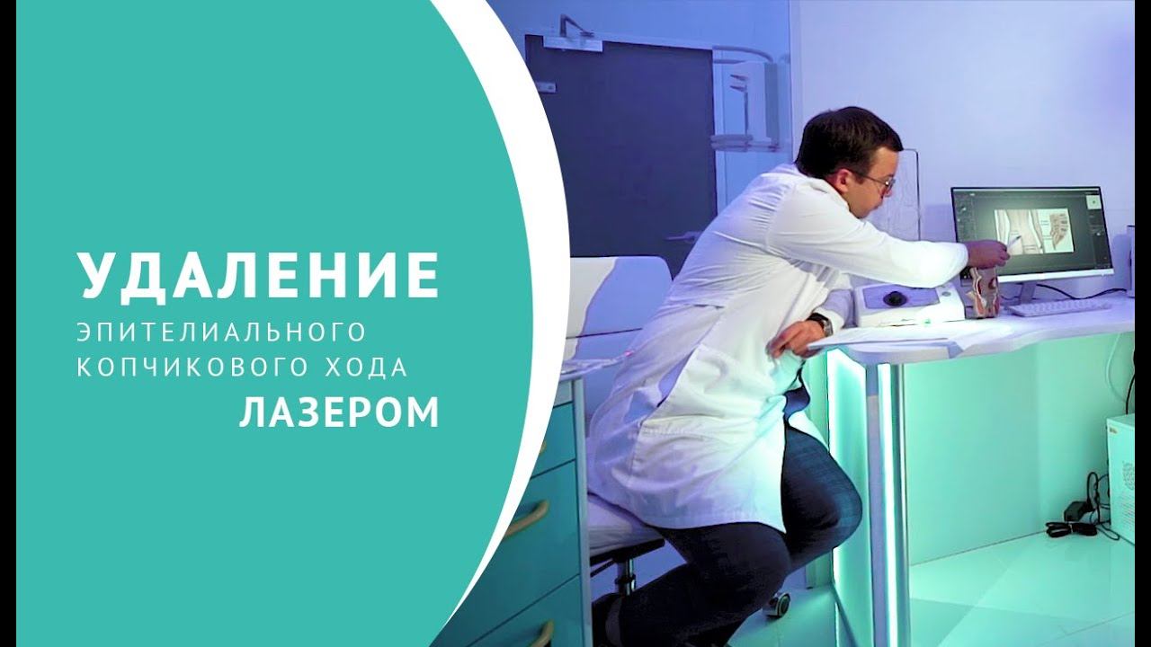Удаление эпителиального копчикового хода лазером смотреть онлайн