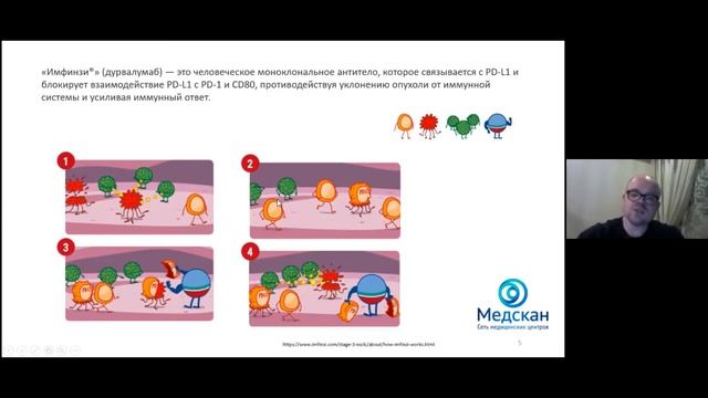 Дурвалумаб: “Game-Changer” для местно-распространённого рака легкого? смотреть онлайн