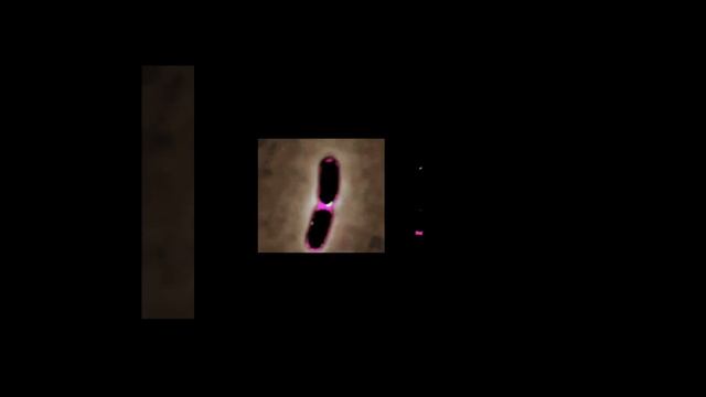 Real image of bacterial cell division#shorts смотреть онлайн