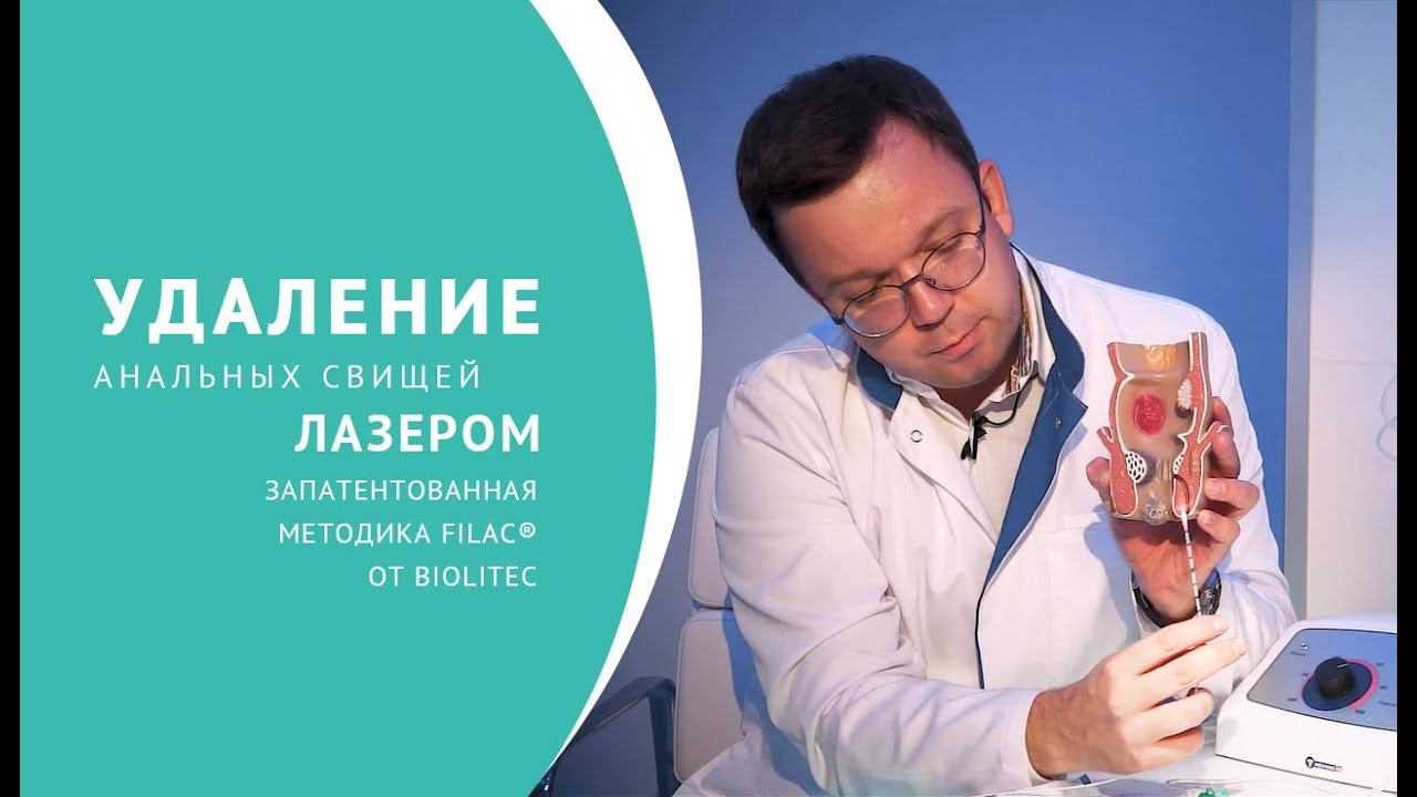 Удаление анальных свищей лазером смотреть онлайн