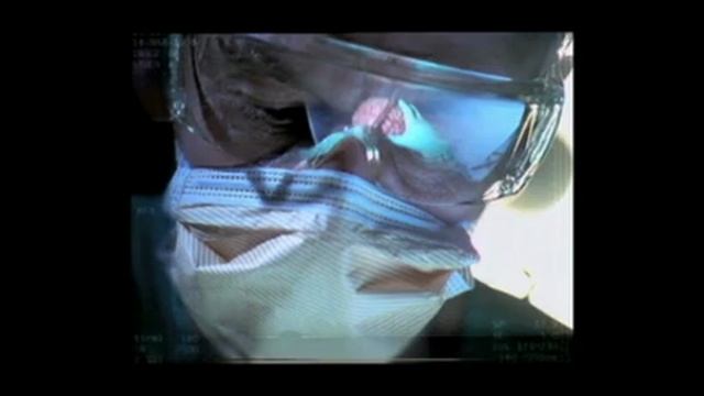 Курение инсульт смотреть онлайн