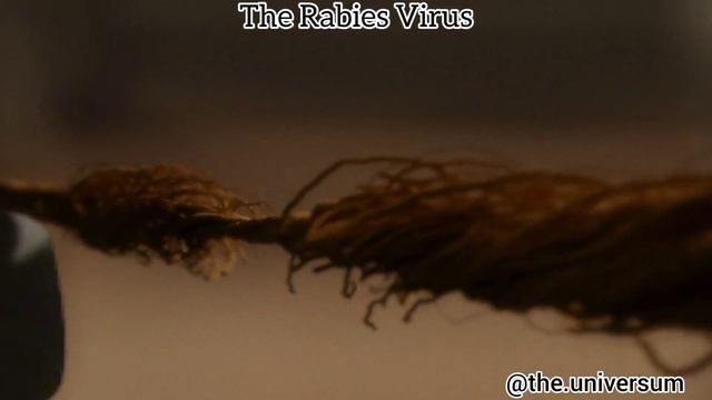 The Rabies Virus cosmos in hindi #facts #science #physics #biology #chemical смотреть онлайн
