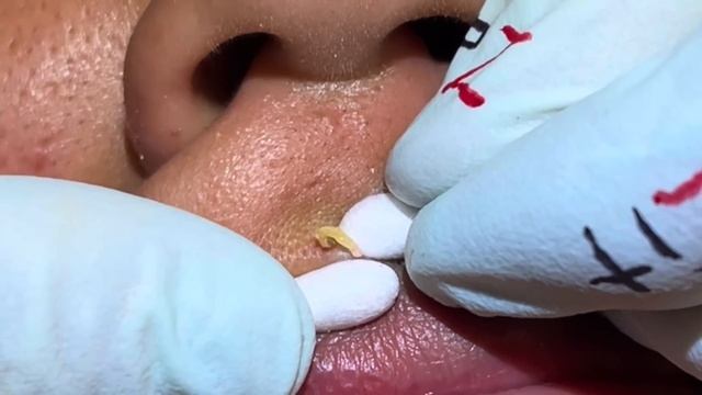 Top Pops volume 1. All kinds of pops from MrPopZit. Some new, some old. смотреть онлайн