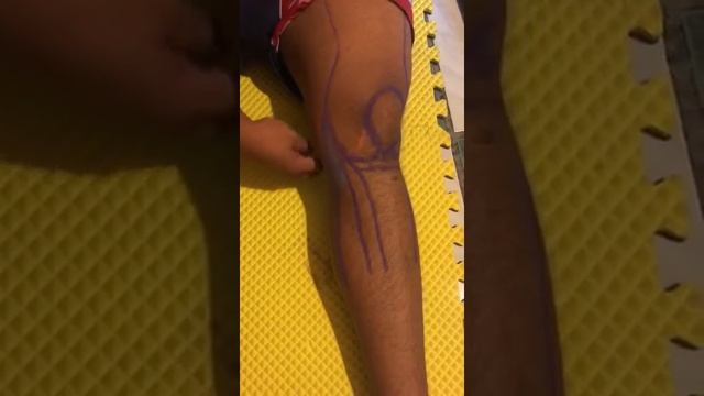 Rodilla смотреть онлайн