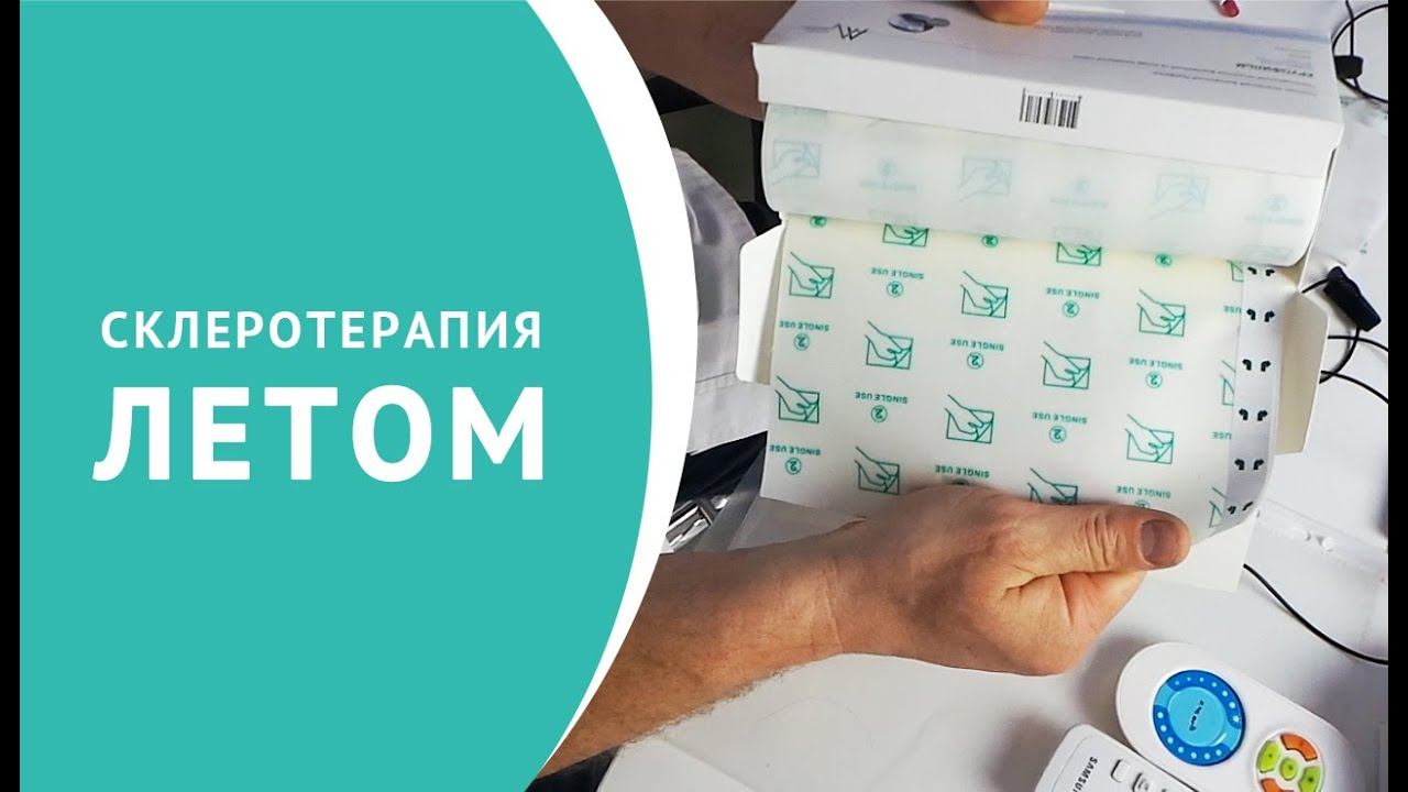 Склеротерапия летом, как делать правильно? смотреть онлайн