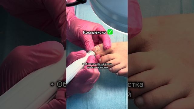 Лечим грибок на всех стадиях ✔️Больше о здоровье ногтей у нас на канале. ПОДПИСЫВАЙТЕСЬ 📲 #shots смотреть онлайн