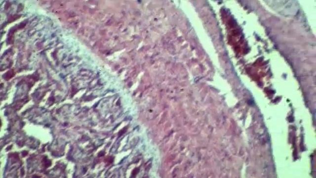 Penis - under microscope Benha faculty of medicine смотреть онлайн