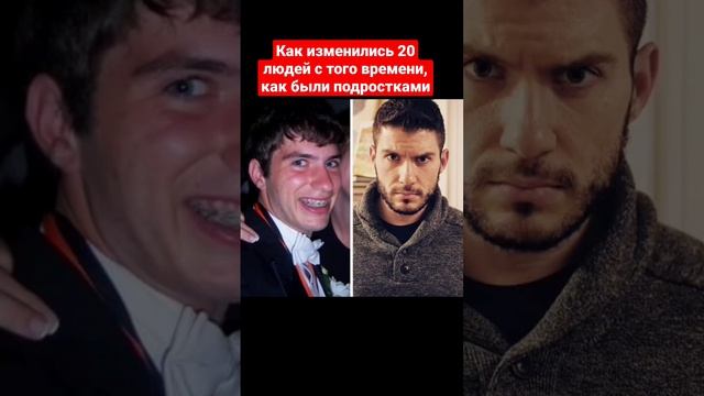 20 людей, которые показали, как они изменились с того времени, когда были подростками #shorts смотреть онлайн