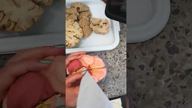 Rhinencephalon1 смотреть онлайн