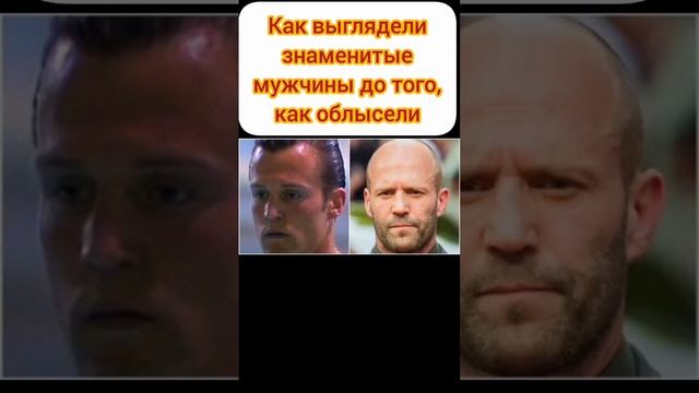Как выглядели известные мужчины до того, как облысели #знаменитости #доипосле #шоубизнес #shorts смотреть онлайн