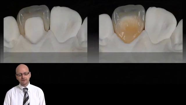 Biomimetic Restorative Dentistry No Post, No Crown - Pascal Magne - Libreria Servicio Medico смотреть онлайн