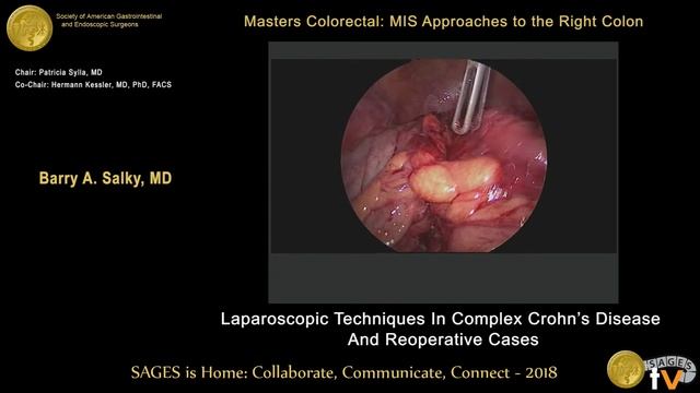 Complex & reoperative Crohn's disease смотреть онлайн