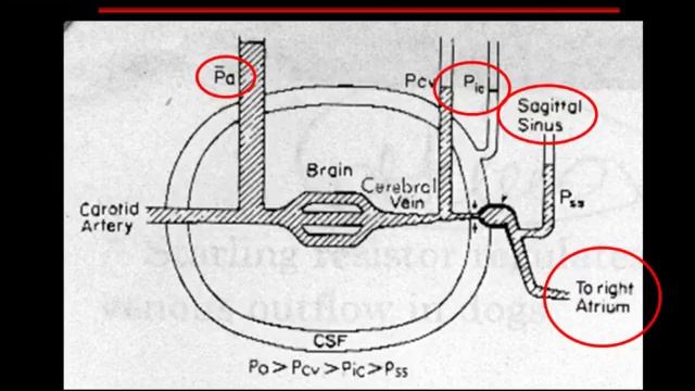 10 Brain injury Luciana MASCIA summerTurin2011