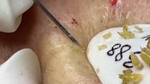 Enjoy Every Day With The Best Video Loan Nguyen Spa Official  1998