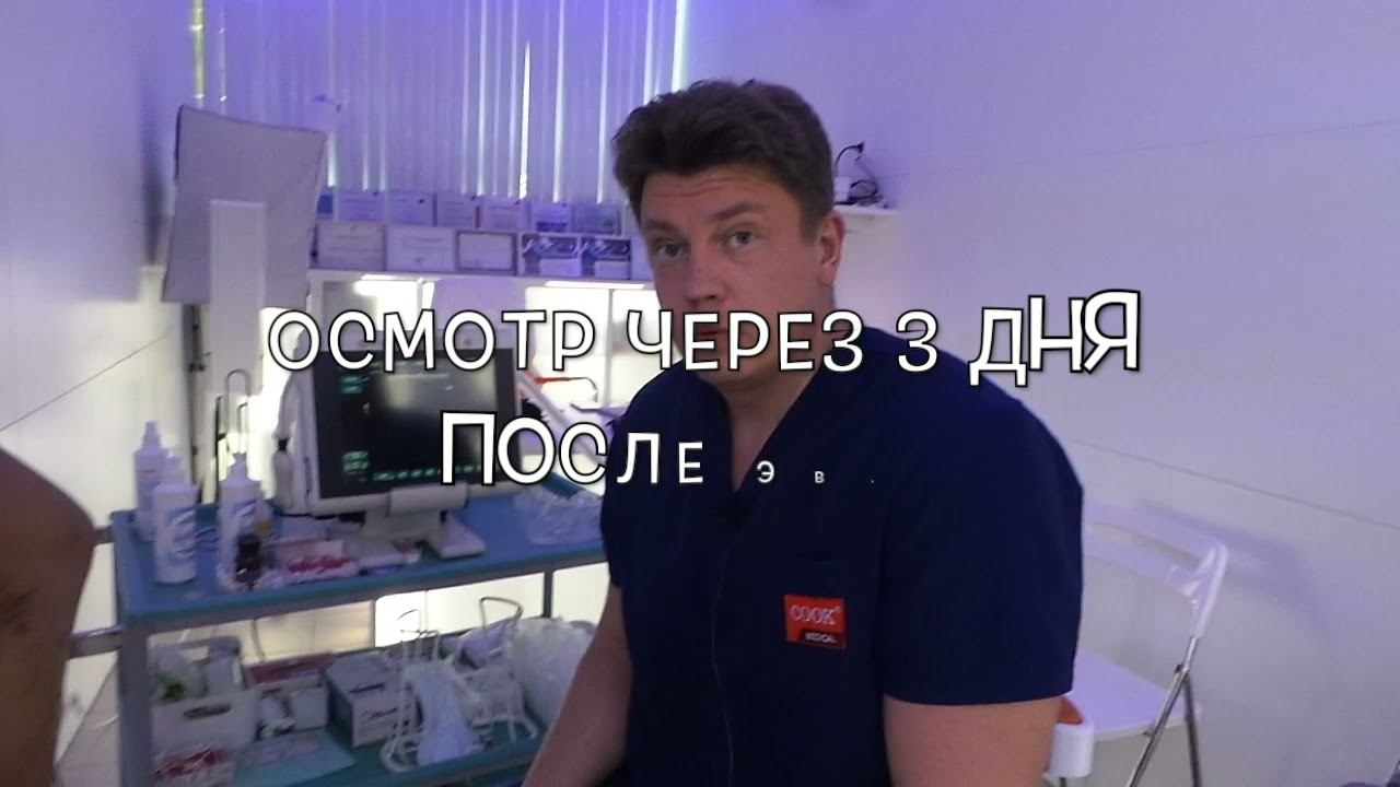 Удаление варикоза лазером у фитнес-модели смотреть онлайн