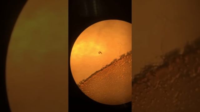 C. elegans Uncoordinated phenotype смотреть онлайн